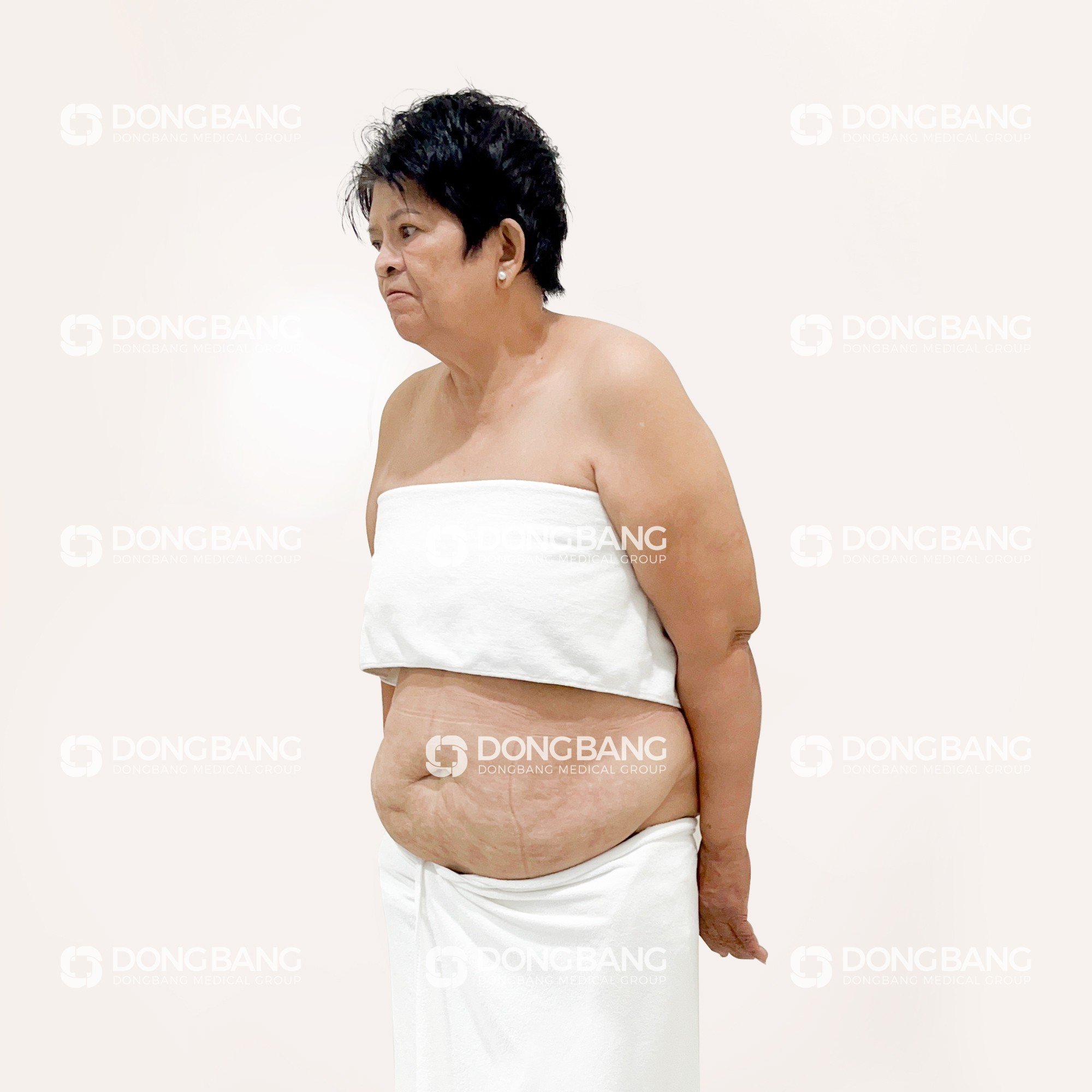 Cô Dung trước giảm cân 