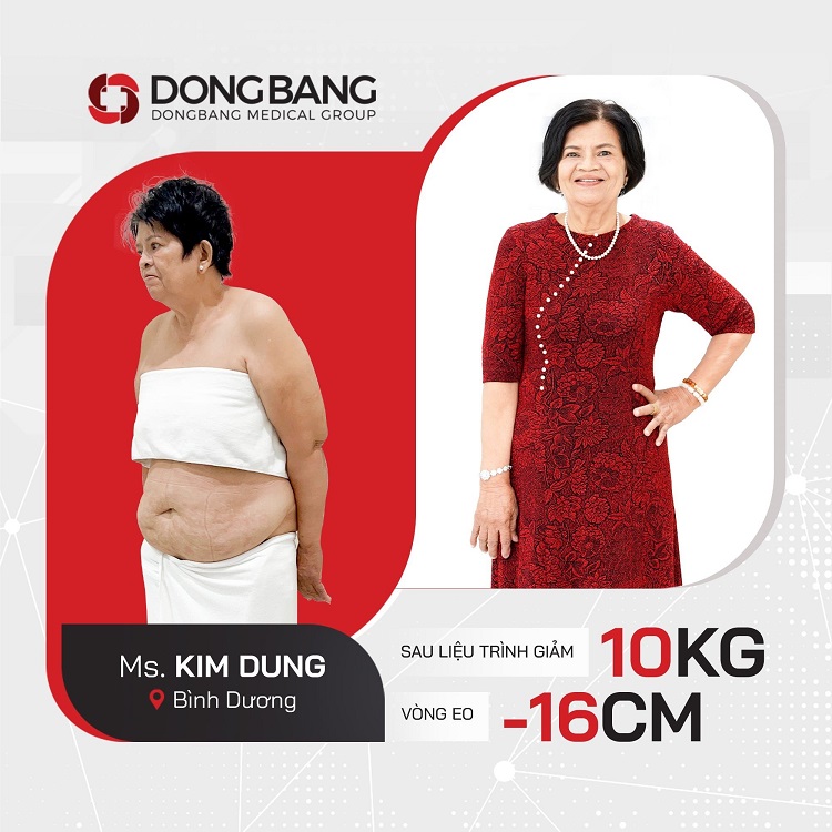 Cô Dung trước và sau giảm cân